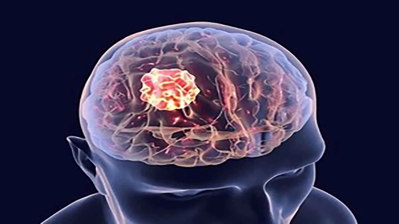 brain