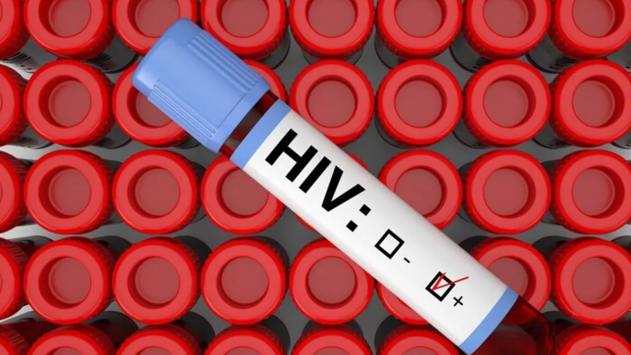 HIV Virus