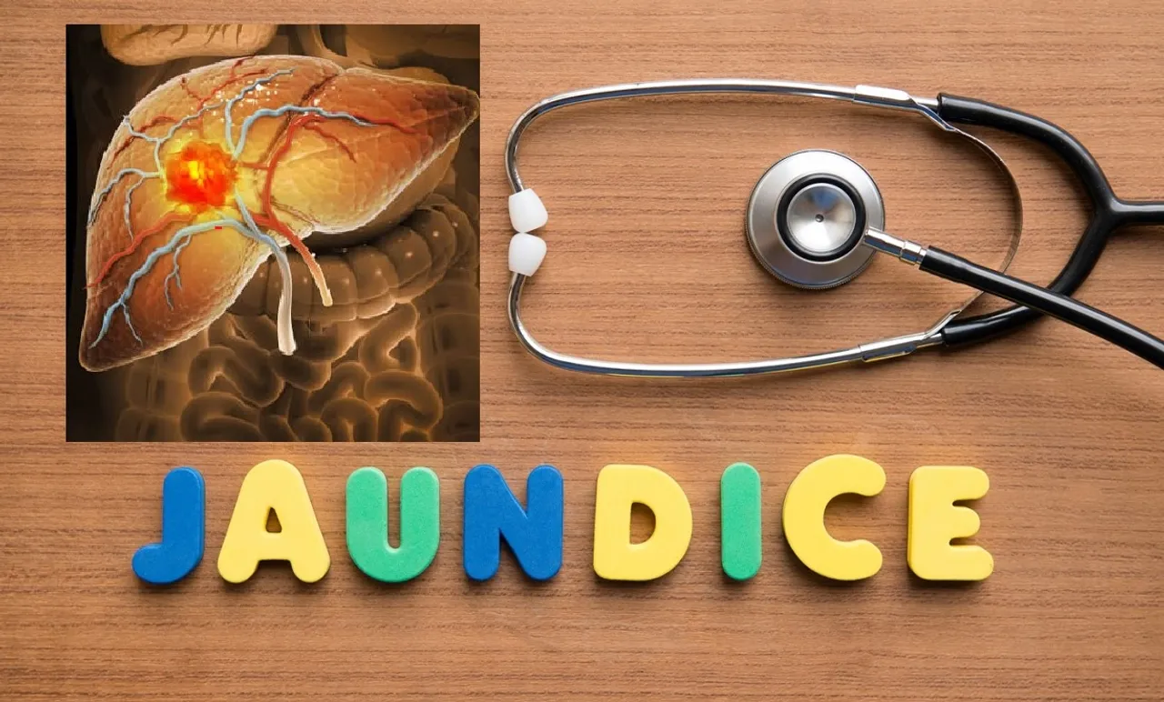 Juandice Treatmant