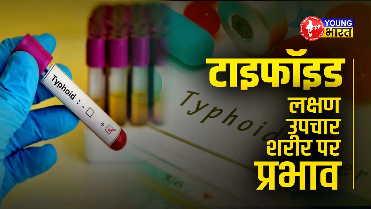 typhoid