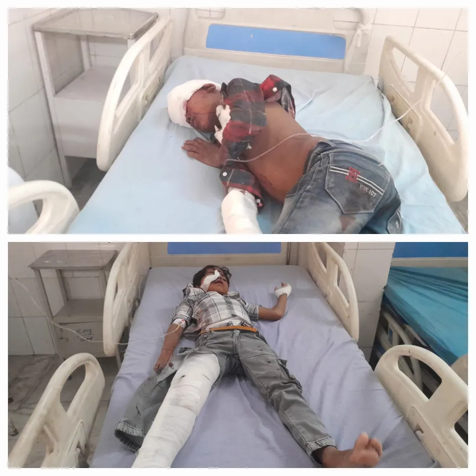फोटो:अस्पताल में भर्ती घायल बच्चे