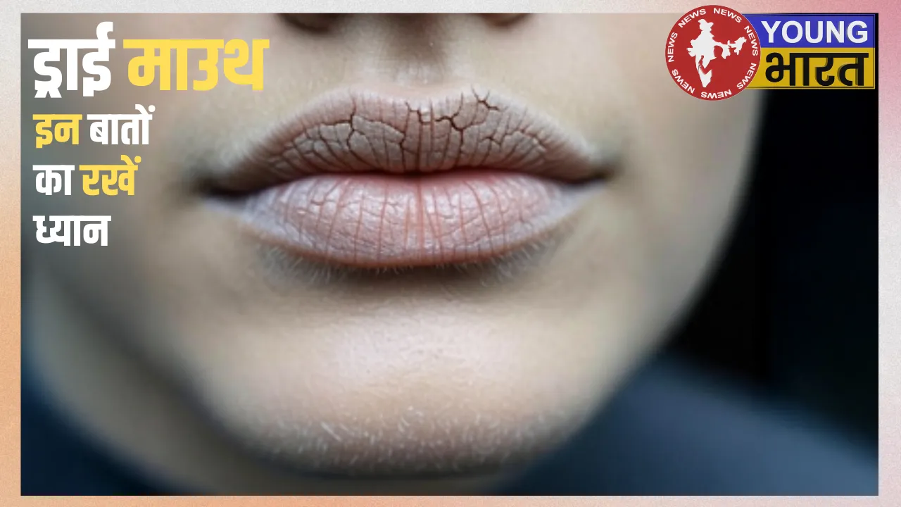 Dry mouth