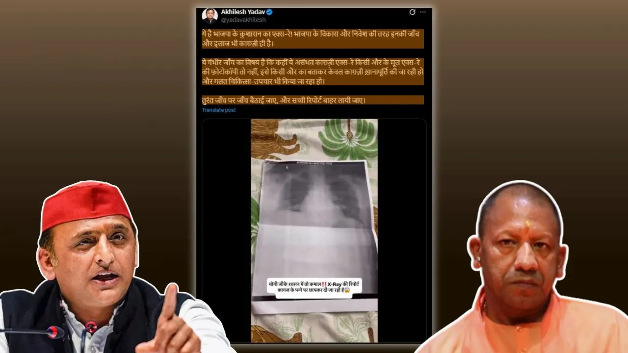 अखिलेश यादव ने एक्स-रे रिपोर्ट को लेकर भाजपा सरकार पर साधा निशाना