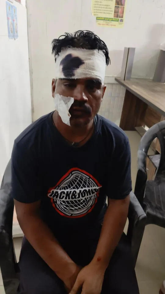 चोट एडिट