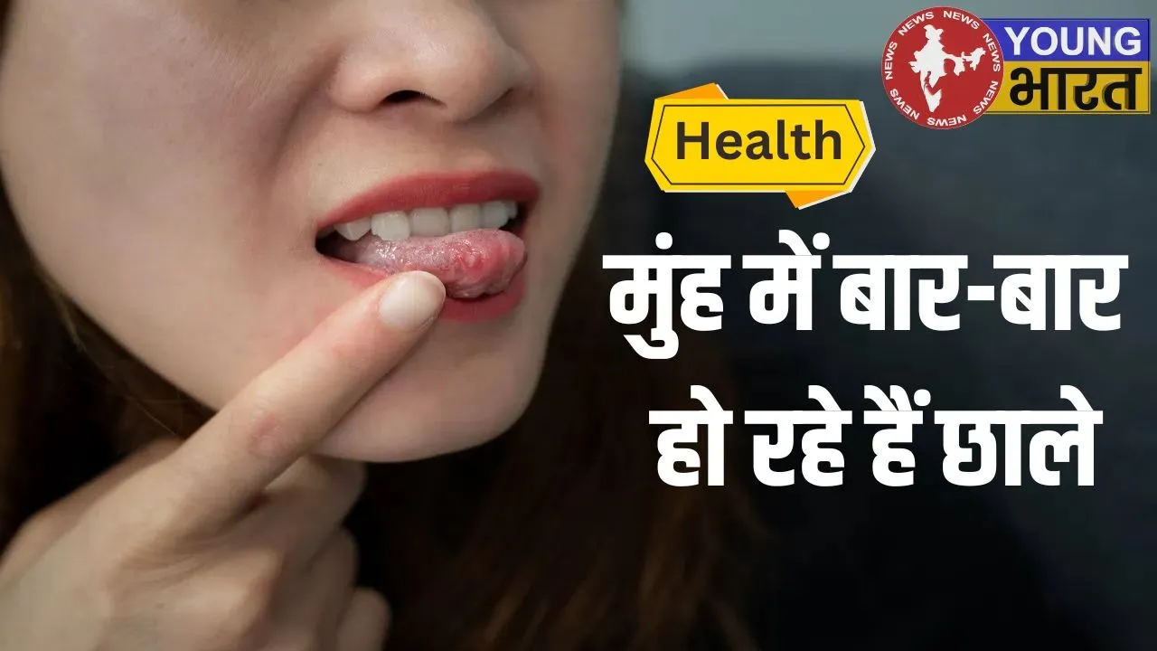 Health Care Mouth care