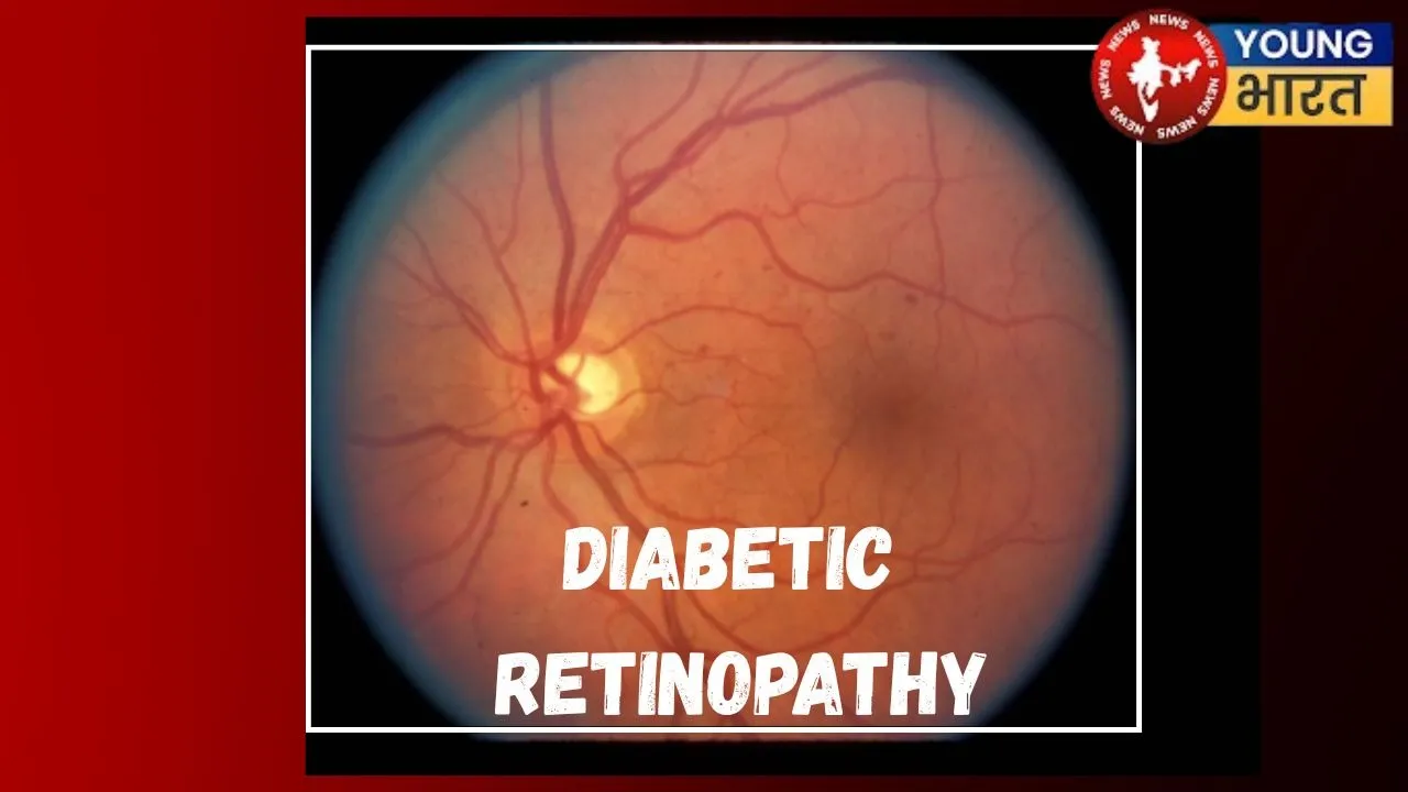 Diabetic Retinopathy
