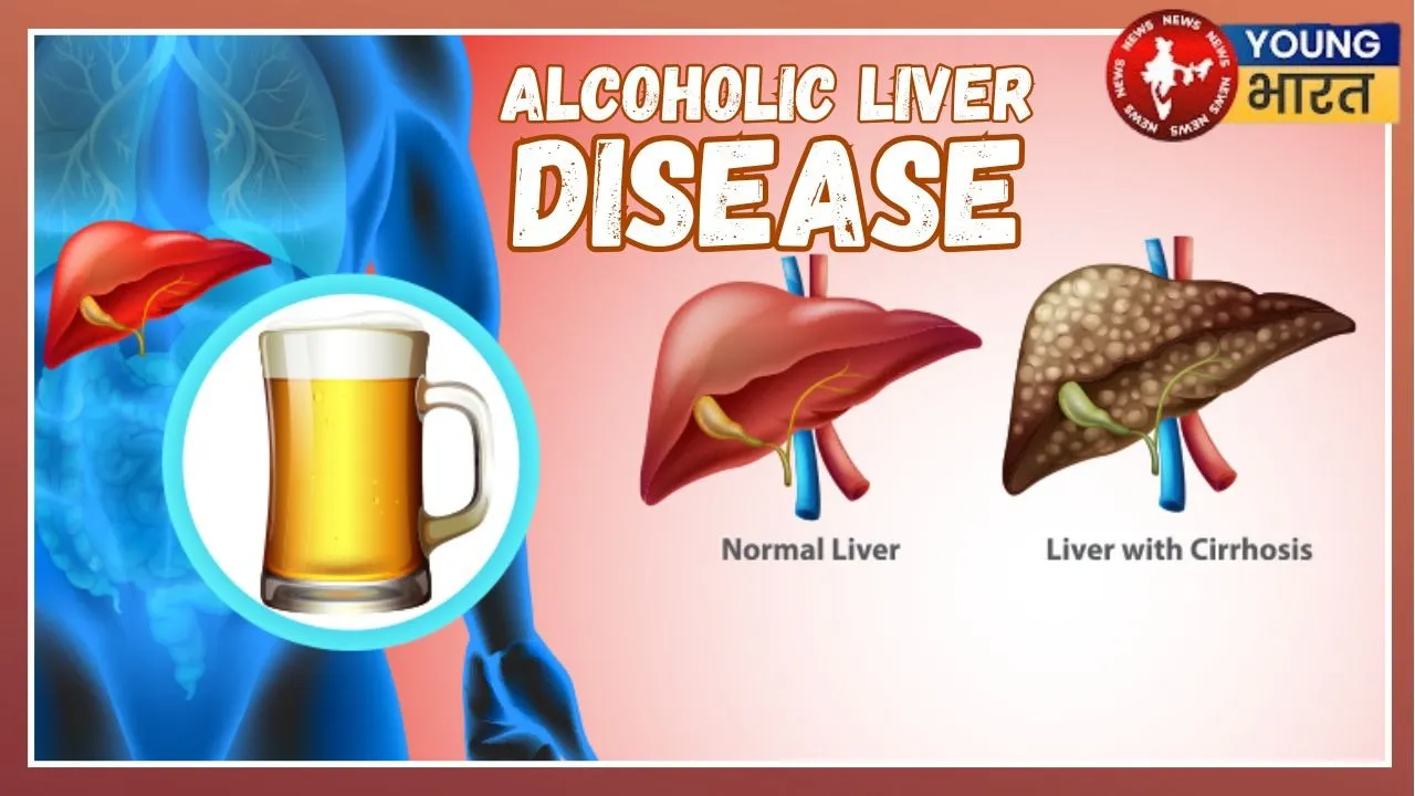 _Alcoholic Disease