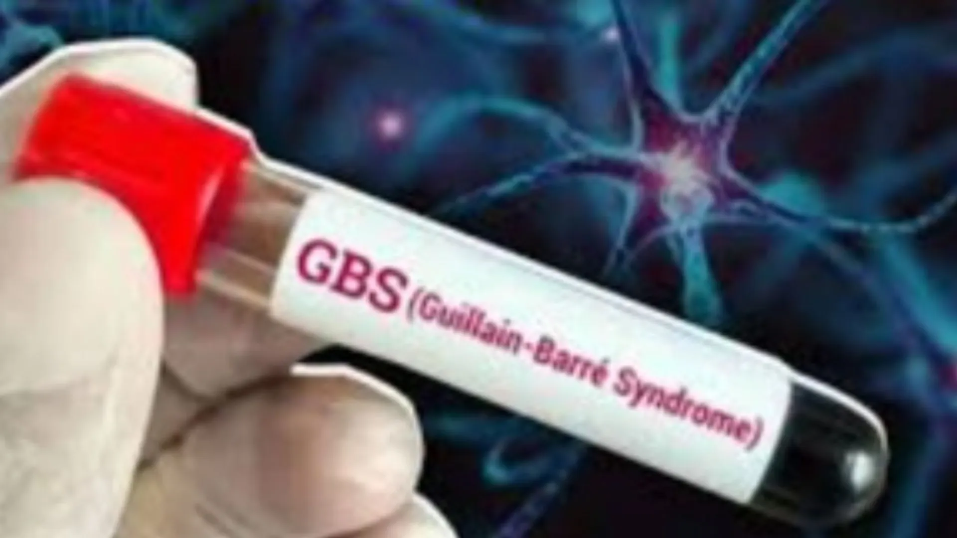 GBS