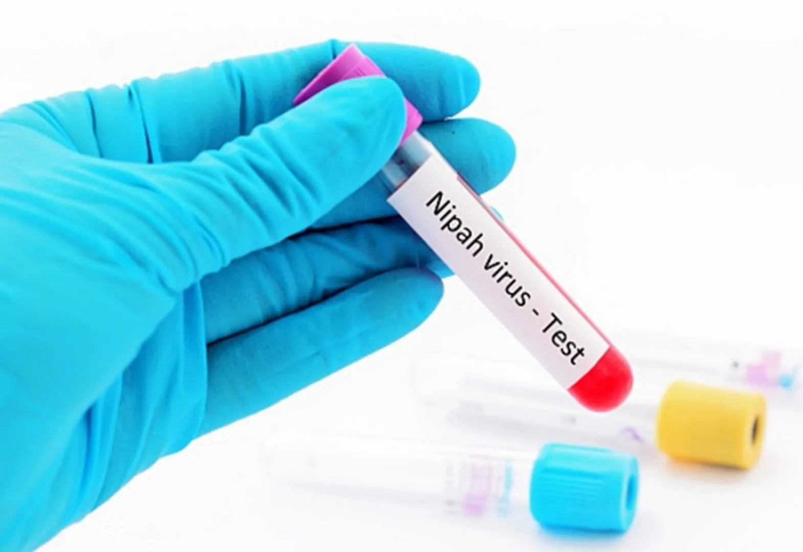 Nipah virus, kerala nipah death, nipah virus news, nipah virus in india, nipah virus symptom,