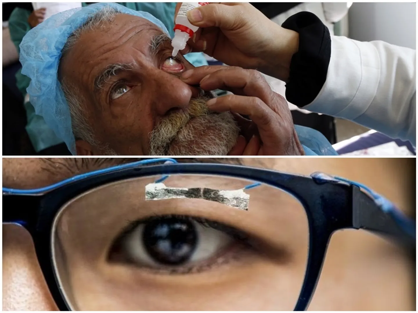 Why was eye drop Presvu which claims to remove glasses banned before its launch in the market