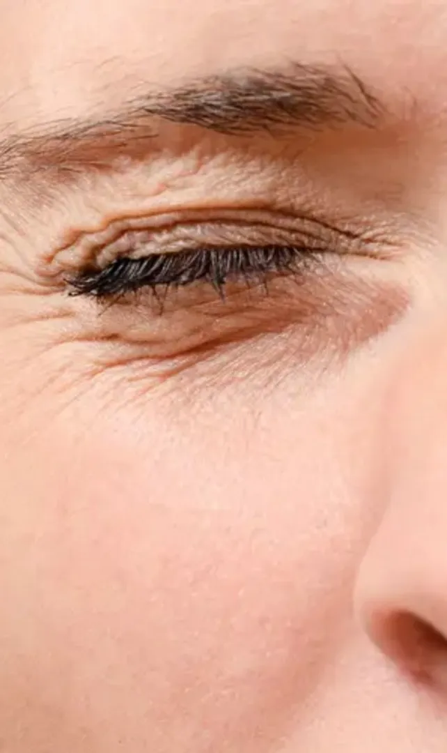 What-Causes-Your-Eyelid-Twitching