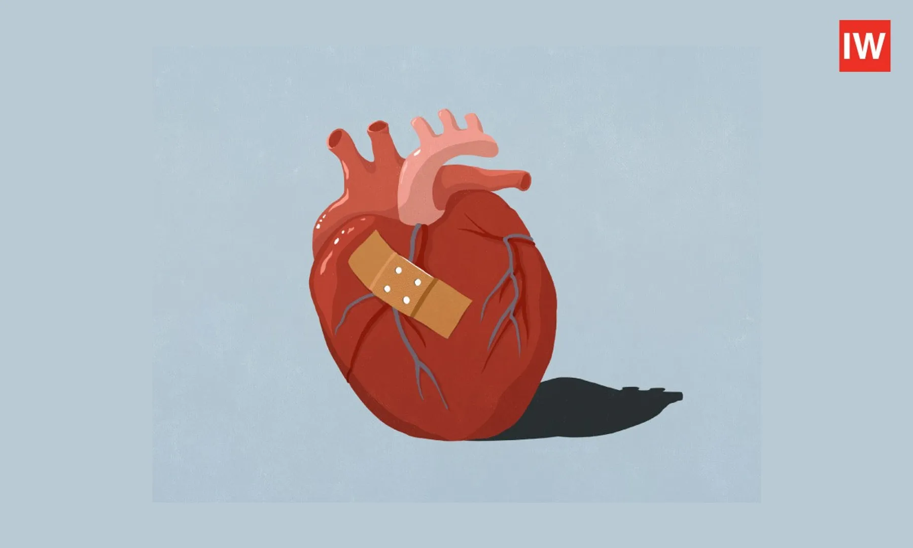 Broken Heart Syndrome