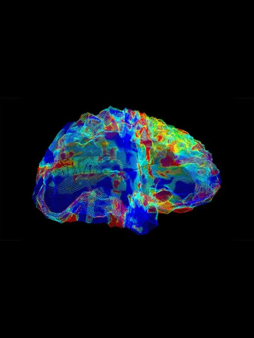 AI-Reads-Brain-Scans-to-Discover-Alzheimer’s-Genes