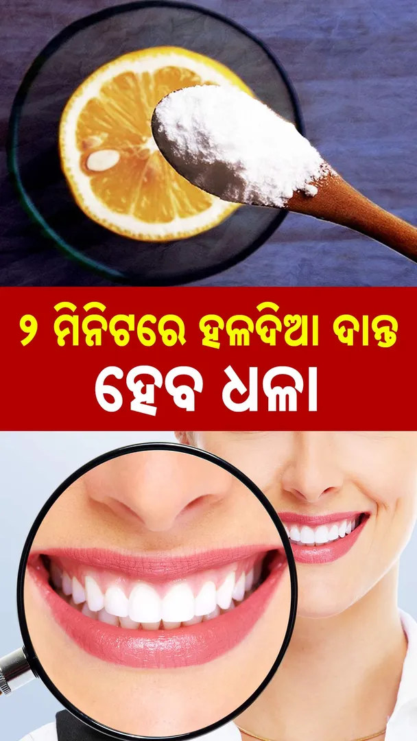 White Teeth