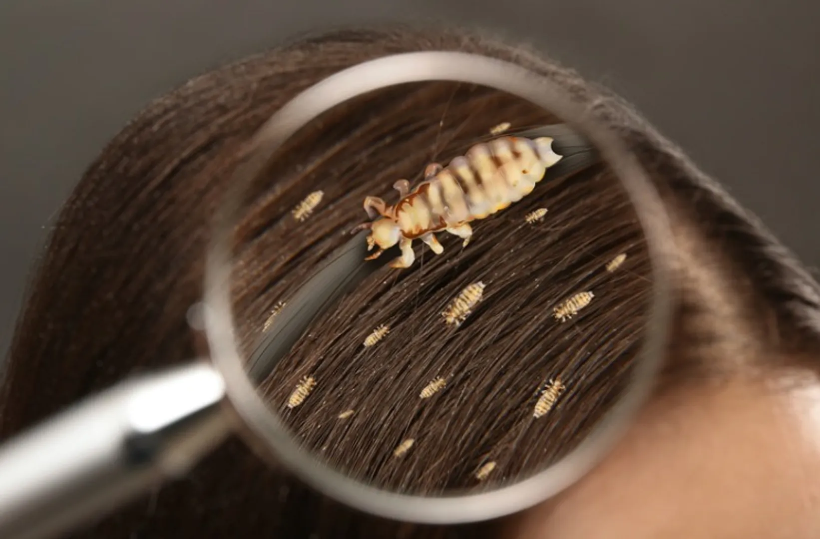 Head-lice