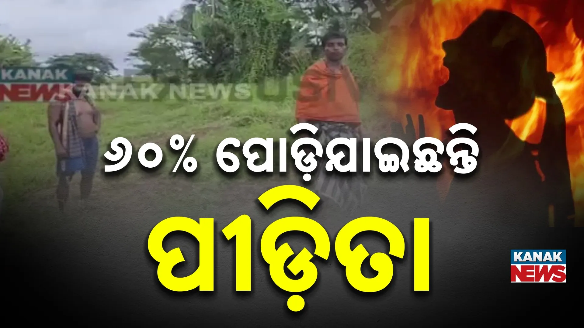 ନାବାଳିକା  ୬୦% ପୋଡି ଯାଇଛନ୍ତି
