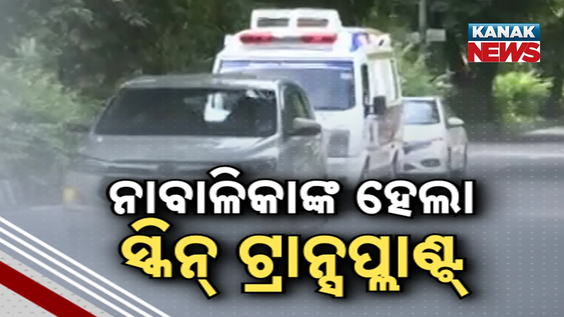 ନାବାଳିକାଙ୍କ ହେଲା ସ୍କିନ୍‌ ଟ୍ରାନ୍ସପ୍ଲାଣ୍ଟ୍‌