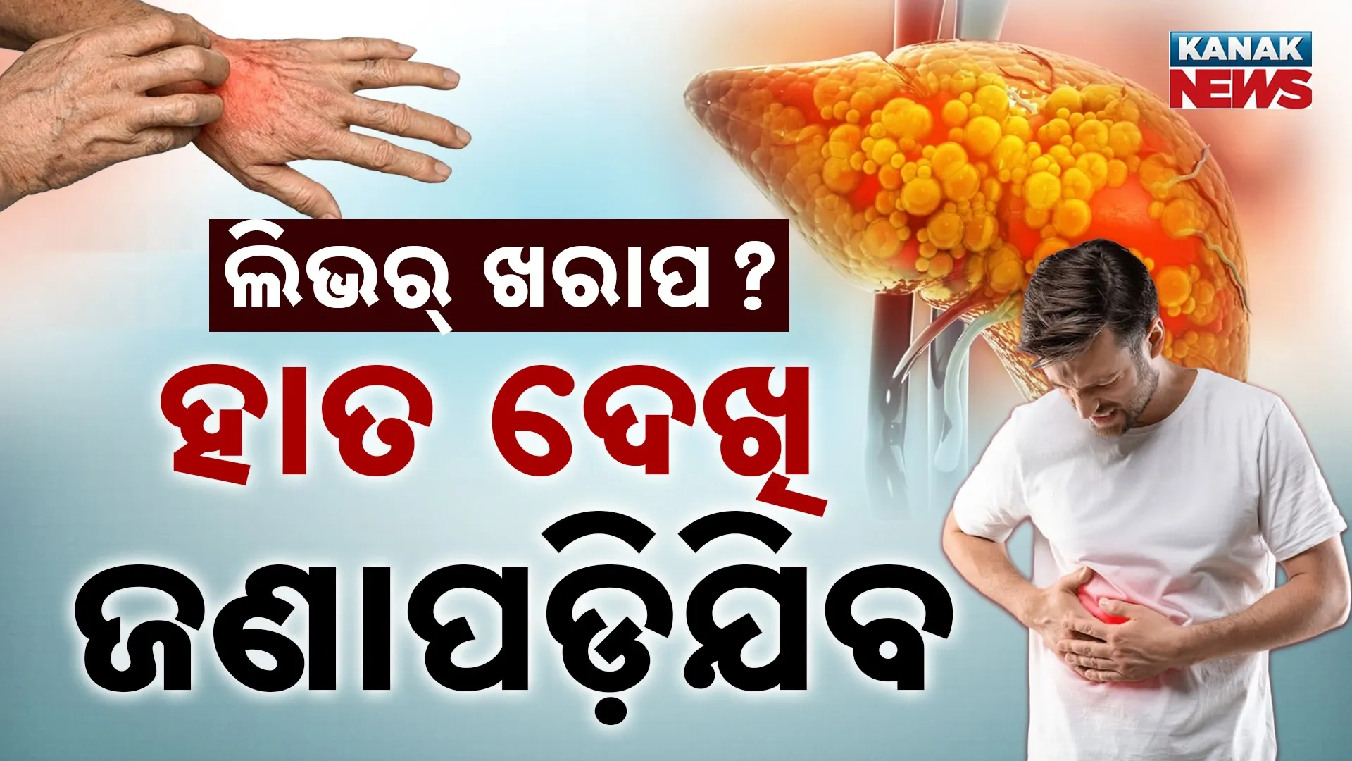 13-Fatty Liver-Anu_thumb