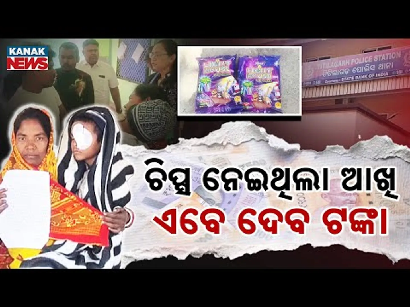 Special Report: 5 Rupee Chips Packet Injures Child Eye, Company to Pay Medical Expenses