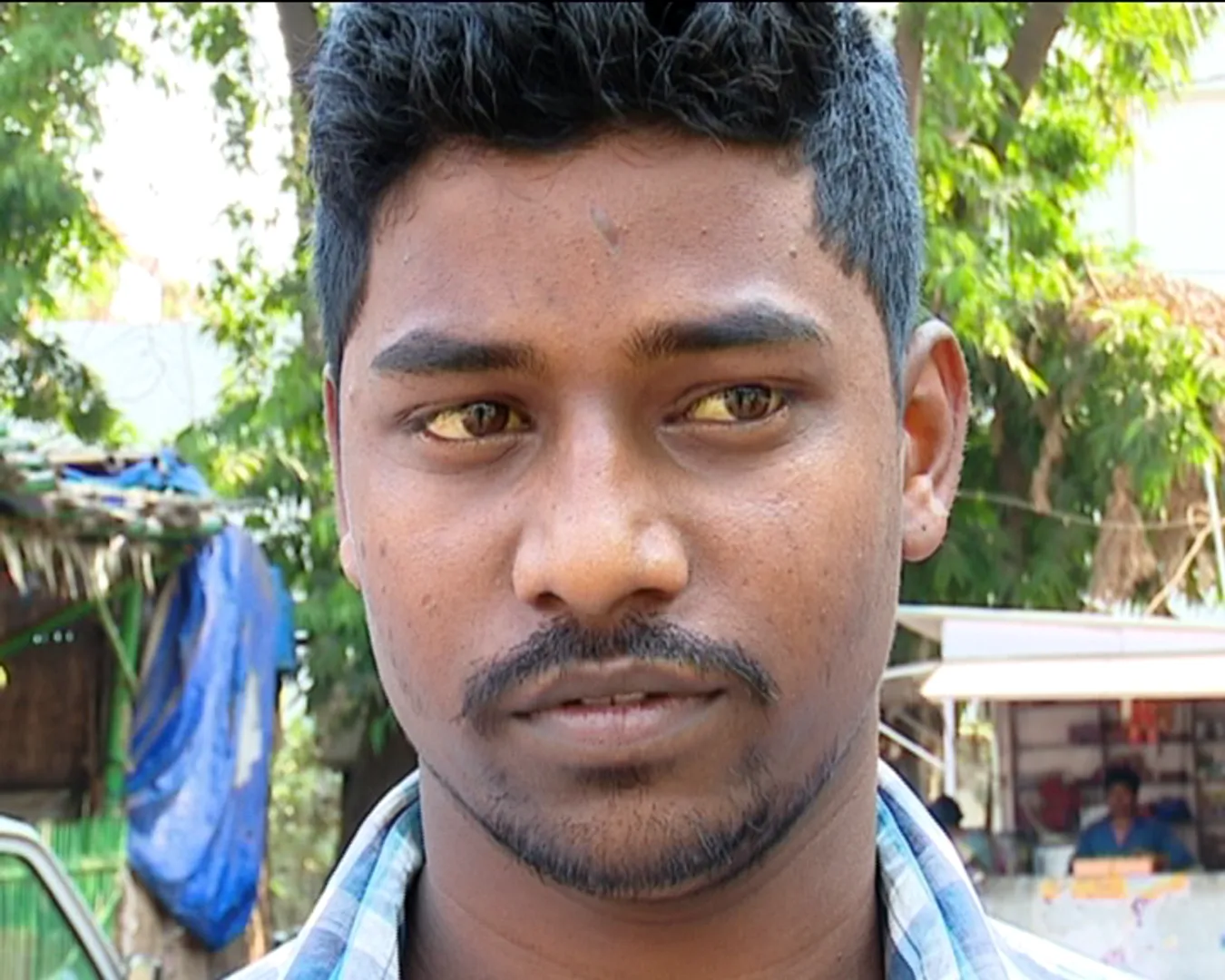 କାୟା ମେଲାଉଛି ଜଣ୍ଡିିସ୍