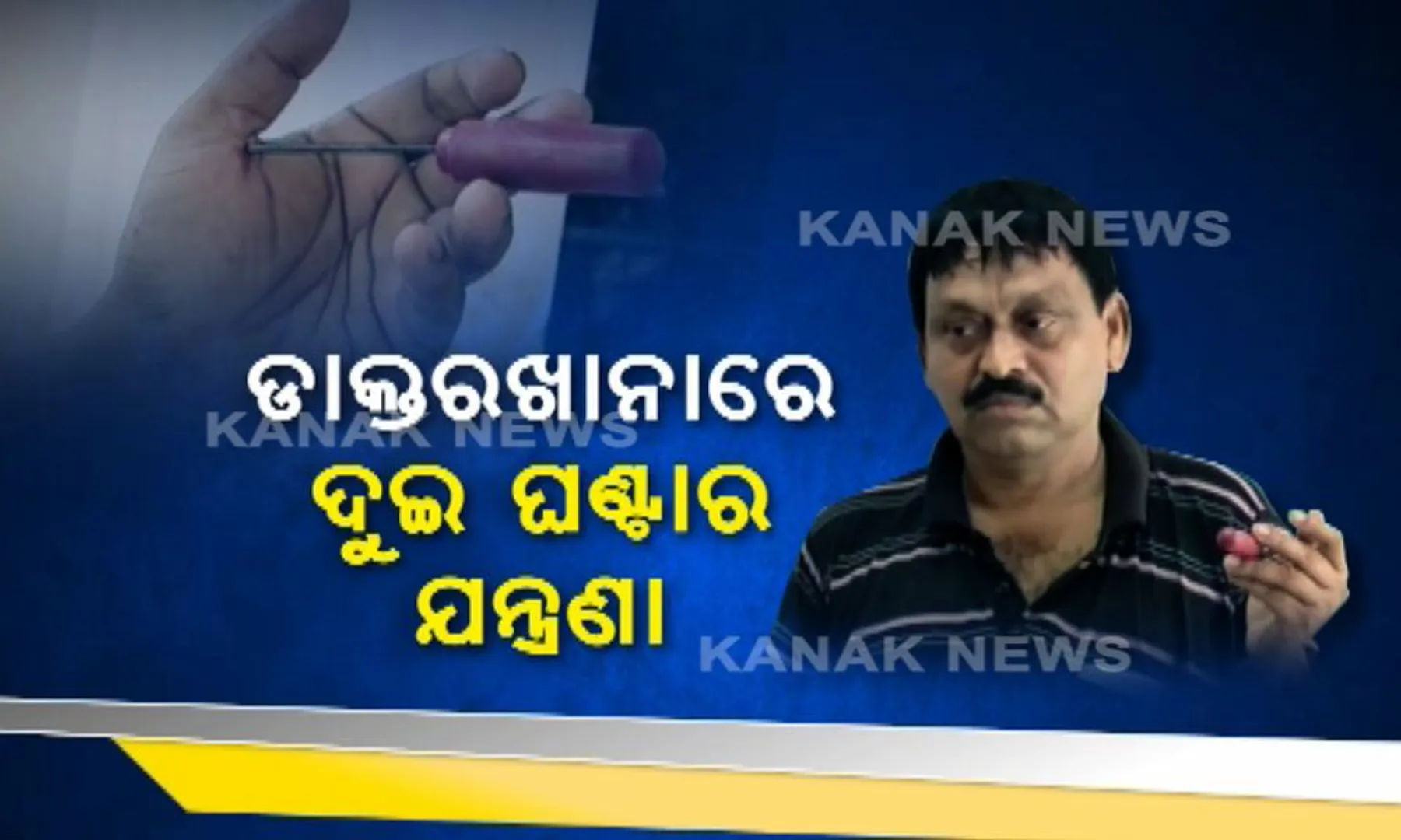 ହାତରେ ଫୁଟି ରହିଥିଲା ଡାମ୍ଫଣ, ଯନ୍ତ୍ରଣାରେ ଛଟପଟ ହେଉଥିଲେ ରୋଗୀ ! ହେଲେ ତୁରନ୍ତ ଚିକିତ୍ସା କରିବାକୁ ମନା କରିଦେଲେ ଡାକ୍ତର ।