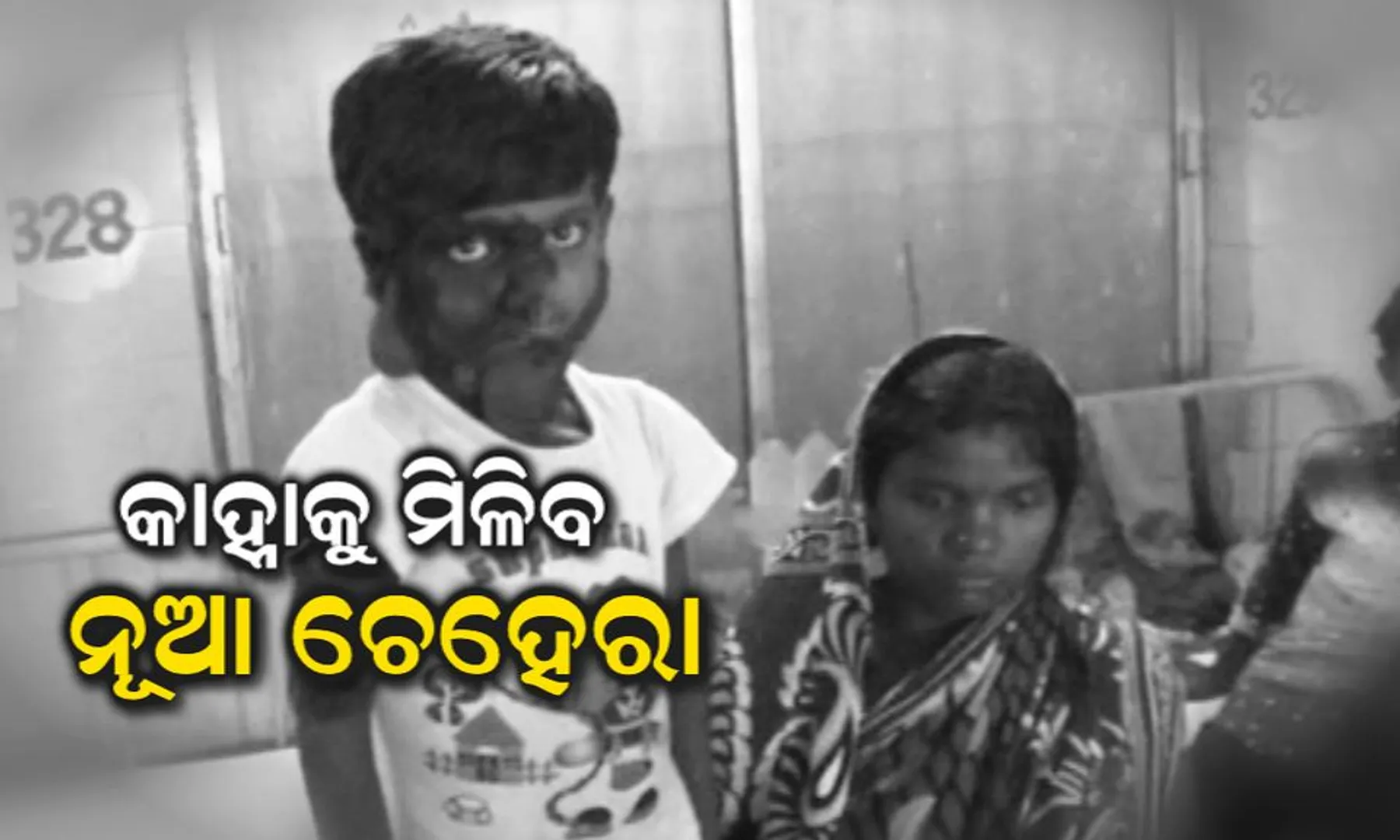 ବ୍ରହ୍ମପୁର ବଡ ମେଡ଼ିକାଲରେ ବିରଳ ଅସ୍ତ୍ରୋପଚାର : କାହ୍ନାକୁ ମିଳିବ ନୂଆ ଚେହେରା, ଓଟିରେ ୭ ଘଂଟାରୁ ଅଧିକ ସମୟ ଧରି ଚାଲିଲା ଅପରେସନ୍