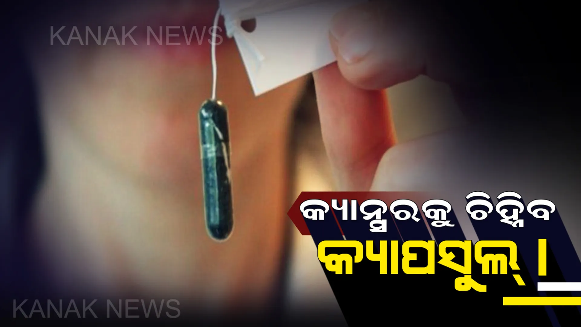 କ୍ୟାନ୍ସର ରୋଗକୁ ଚିହ୍ନିବାରେ ସହାୟକ ହେବ ଏହି ଛୋଟିଆ କ୍ୟାପସୁଲ୍ ! ଆପଣଙ୍କୁ କ୍ୟାନ୍ସର ହୋଇଛି କି ନାହିଁ ଚୁଟକି ମାରି ଜାଣିପାରିବେ ।