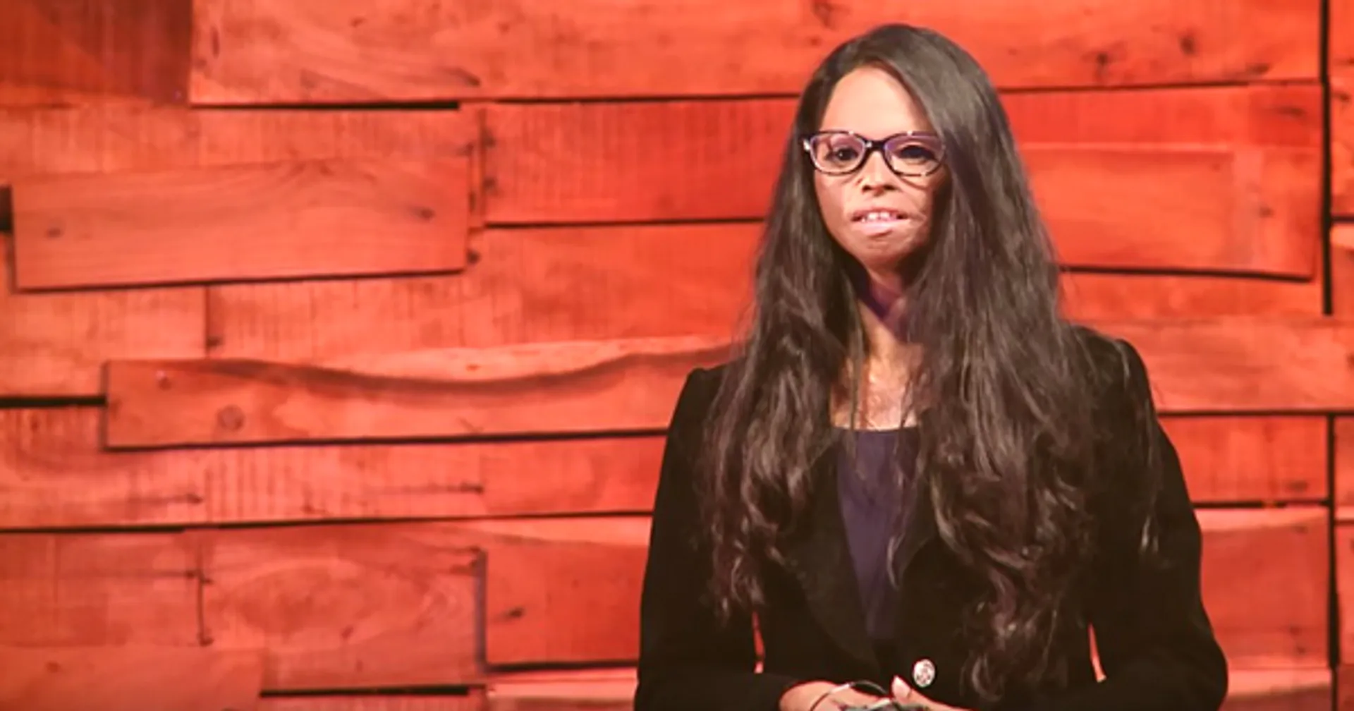 ଏସିଡ୍ ପୀଡିତାଙ୍କ ଆତ୍ମବିଶ୍ୱାସ ହରାଉଛି ଚାକିରୀ ! ପୁରସ୍କାର,ସମ୍ମାନ ମିଳିଥିଲେ ମଧ୍ୟ ଚାକିରୀଟିଏ ପାଇଁ ହନ୍ତସନ୍ତ ହେଉଛନ୍ତି ପୀଡିତା ।