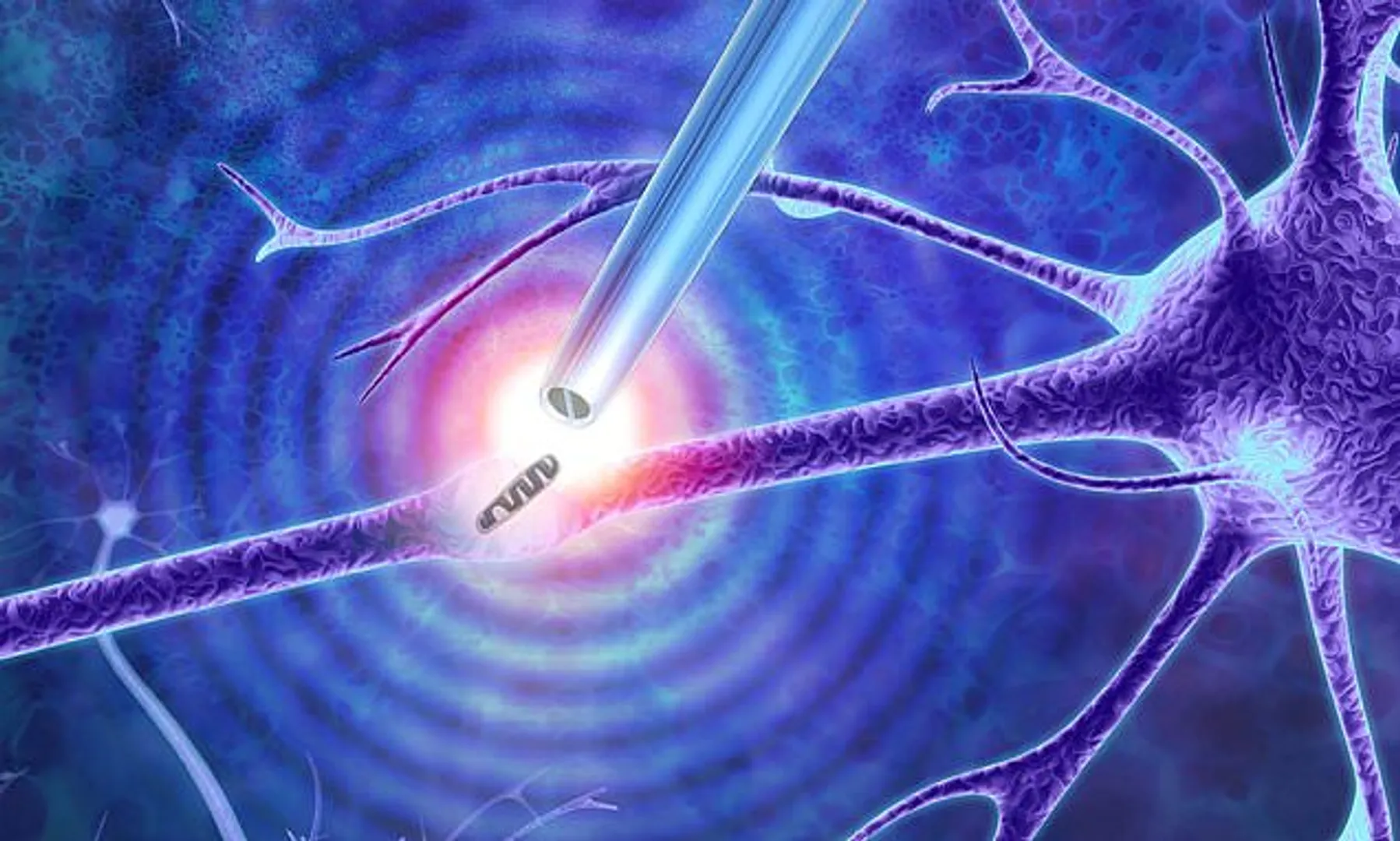 ଚୁଟି ଠାରୁ ୨୦୦୦ ଗୁଣ ପତଳା ଚିମୁଟା କହିବ ଆପଣଙ୍କୁ ହୋଇଛି କେଉଁ ରୋଗ ! ସର୍ଜରୀ ସମୟରେ ଡାକ୍ତରଙ୍କୁ କରିବ ସାହାଯ୍ୟ ।