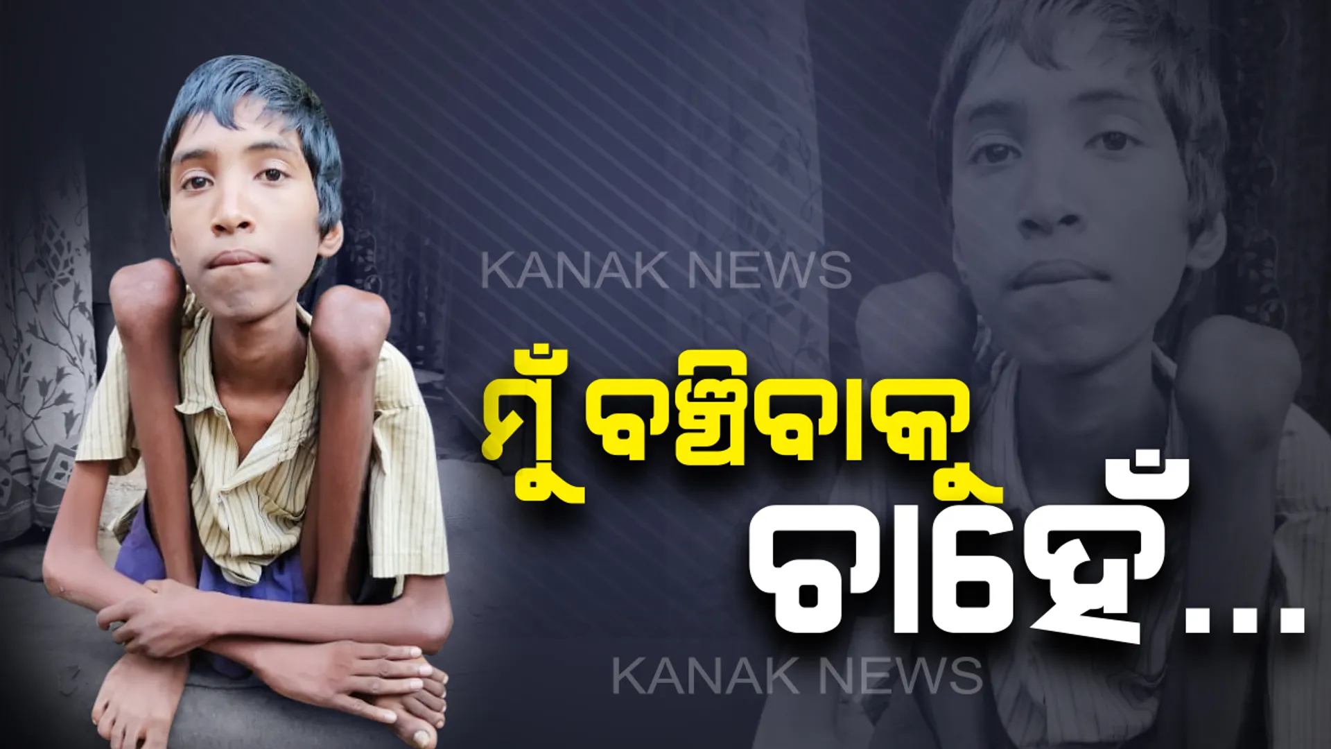 ଯନ୍ତ୍ରଣାରେ ଜୁଝୁଛି ୧୬ ବର୍ଷର ବାଳକ: ଡାକ୍ତରଙ୍କୁ ଦେଖାଇବାକୁ ବାପାମାଆଙ୍କ ପାଖରେ ନାହିଁ ସାମର୍ଥ୍ୟ..ସାହାଯ୍ୟ ଆଶାରେ କୁଳମଣି ମୁହଁରୁ ଭାସି ଆସୁଛି ଏକ ନୀରବ ସ୍ୱର...ମୁଁ ବଞ୍ଚିବାକୁ ଚାହେଁ