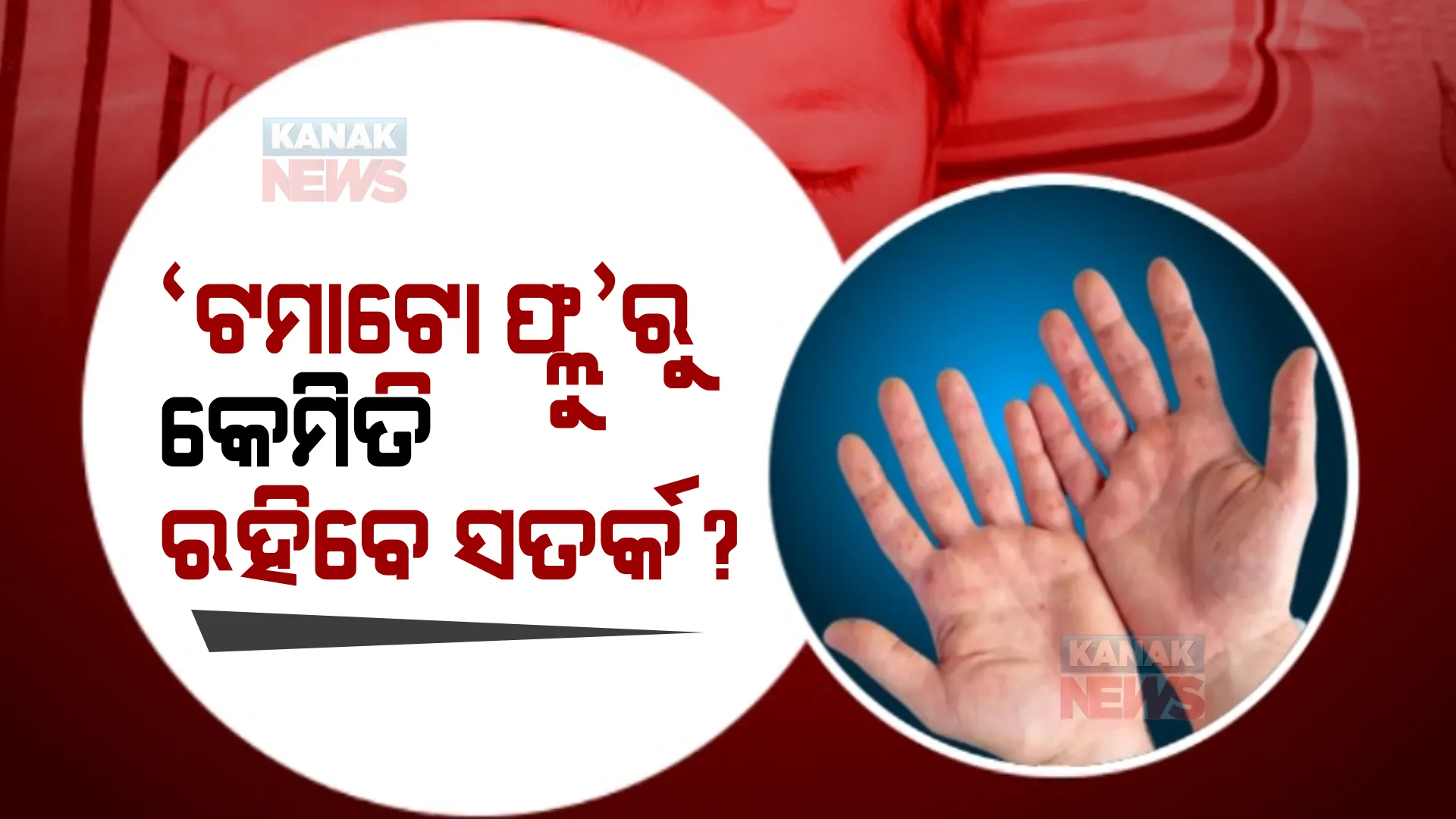 ତାମିଲନାଡୁ ଓ କର୍ଣ୍ଣାଟକ ପରେ ‘ଟମାଟୋ ଫ୍ଲୁ’କୁ ନେଇ ଓଡ଼ିଶାରେ ଆତଙ୍କ । ‘ଟମାଟୋ ଫ୍ଲୁ’ରୁ କେମିତି ରହିବେ ସତର୍କ?