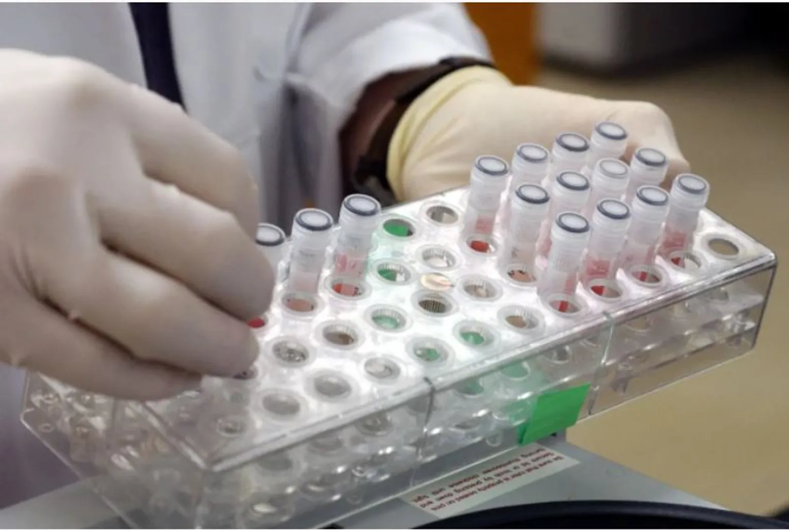 କରୋନା ପରେ ‘ମଙ୍କିପକ୍ସ’ । ବ୍ରିଟେନବାସୀଙ୍କର ବଢିଲା ଚିନ୍ତା । କ’ଣ ଏହି ମଙ୍କିପକ୍ସ ଭାଇରସ ପଢନ୍ତୁ ...