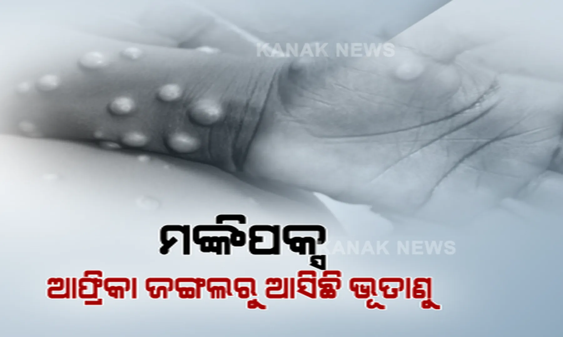 ବ୍ୟାପିଲାଣି ମଙ୍କିପକ୍ସ ଭୂତାଣୁ, ବଢିଲାଣି ଚିନ୍ତା । ଆସନ୍ତାକାଲି ବସିବ ଗୁରୁତ୍ୱପୂର୍ଣ୍ଣ ବୈଠକ, ରାଜ୍ୟ ଗୁଡିକ ପାଇଁ ଆସିପାରେ ଗାଇଡଲାଇନ ।