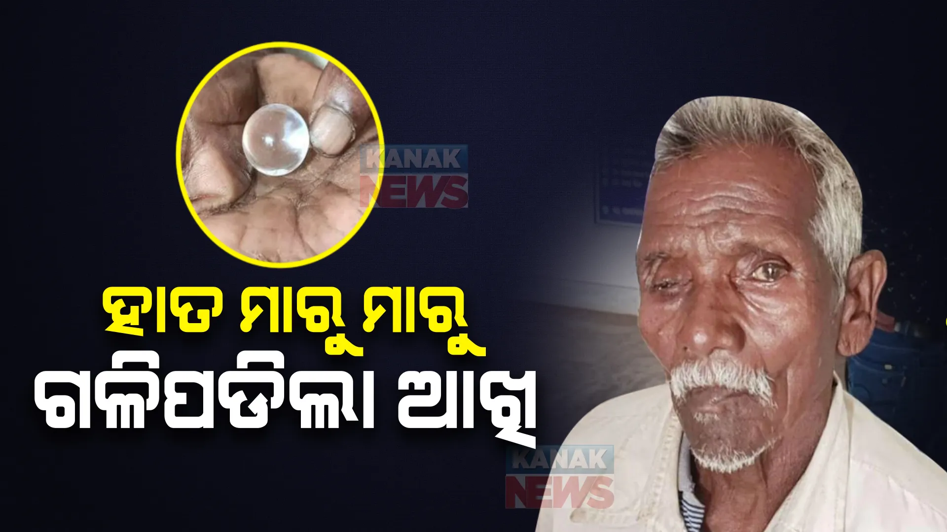 ହାତ ଲଗେଇବା ମାତ୍ରେ ତଳକୁ ଖସିପଡିଲା ଆଖି, ମେଡିକାଲରେ ପହଂଚିବା ପରେ ଜଣା ପଡିଲା ହୋଇଛି ଆଖି ଚୋରି