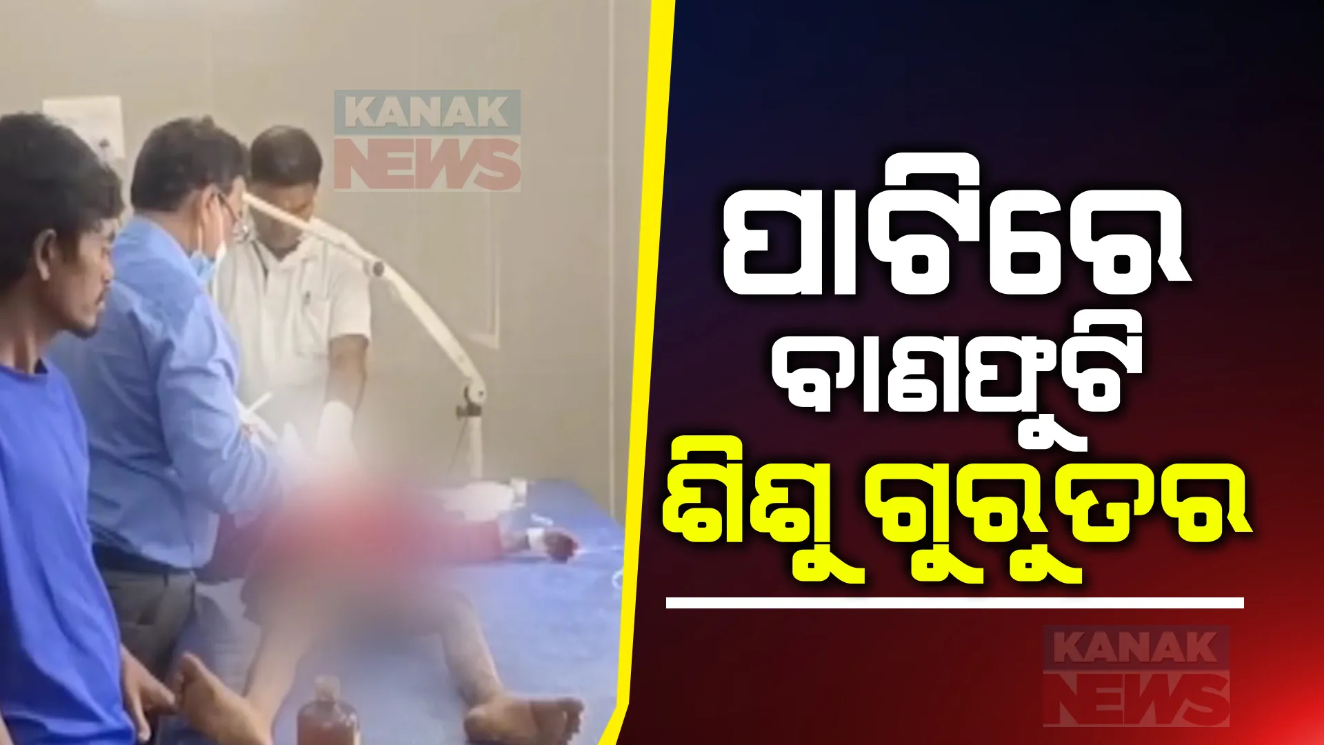ପାଟିରେ ବାଣଫୁଟି ୬ ବର୍ଷର ଶିଶୁ କନ୍ୟା ଗୁରୁତର । ଅଫୁଟା ବାଣକୁ ଗୋଟେଇ ଚୋବାଇବାରୁ ପାଟିରେ ହେଲା ବିସ୍ଫୋରଣ