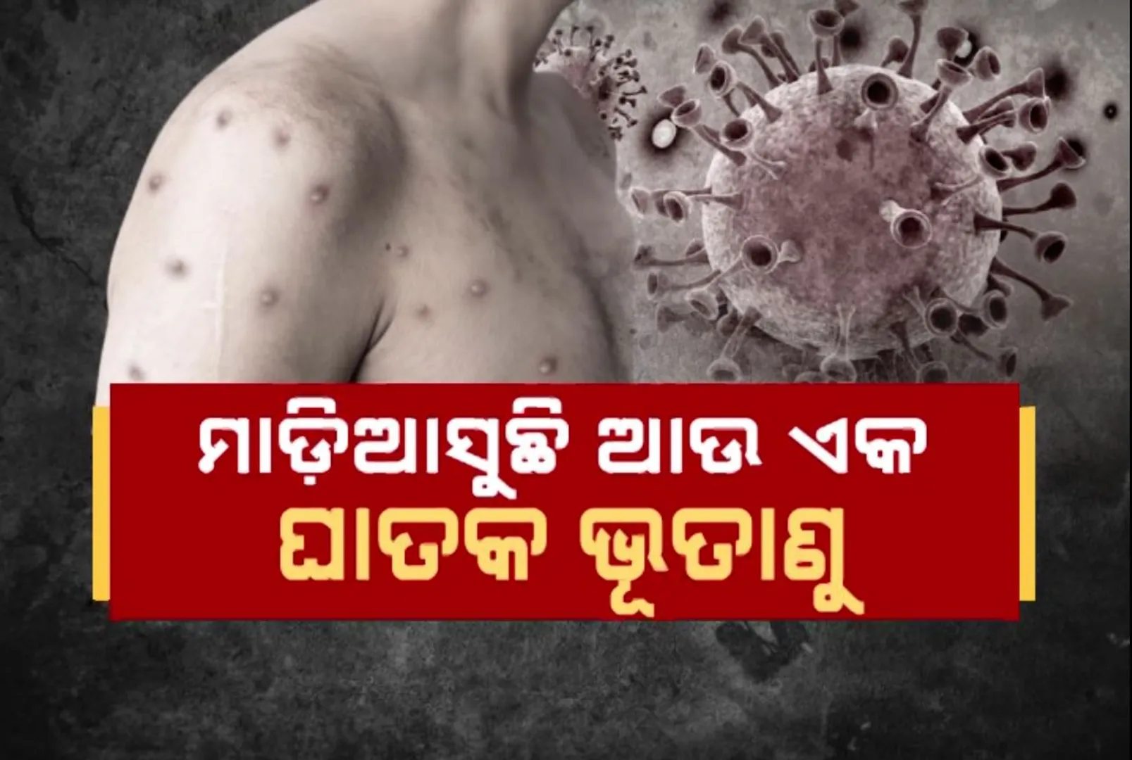 ମଙ୍କିଫକ୍ସକୁ ନେଇ ଆଲର୍ଟରେ ସରକାର । ସ୍ୱାସ୍ଥ୍ୟ ଅଧିକାରୀଙ୍କ ସହ ଜେପି ନଡ୍ଡାଙ୍କ ସମୀକ୍ଷା ବୈଠକ
