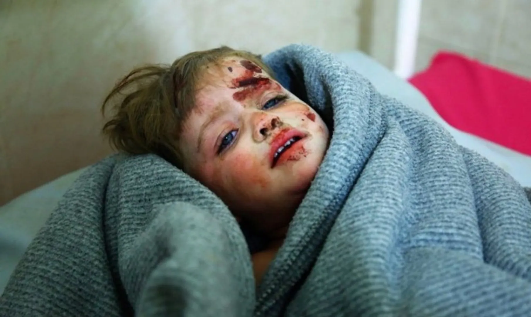 Syrian war attack