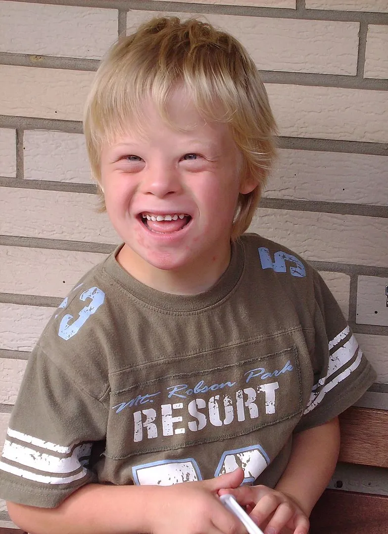 Down Syndrome boy