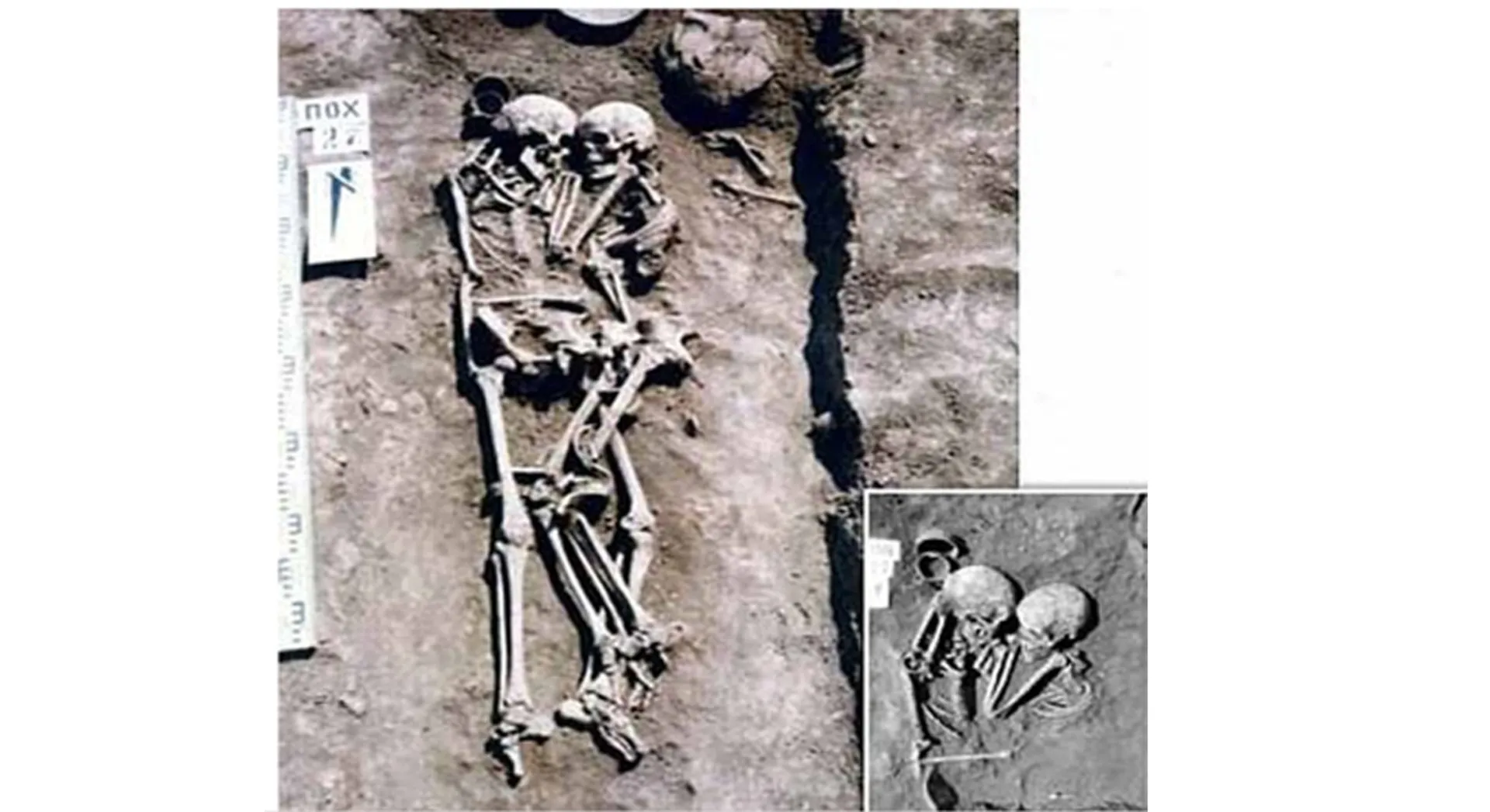  skeleton