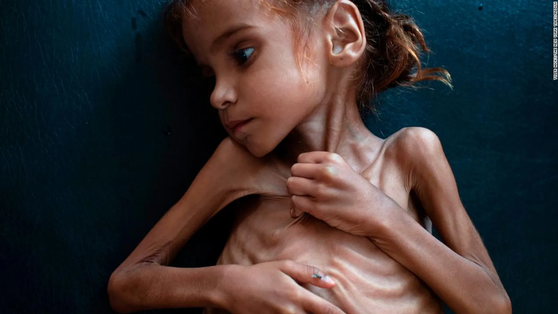 yemen