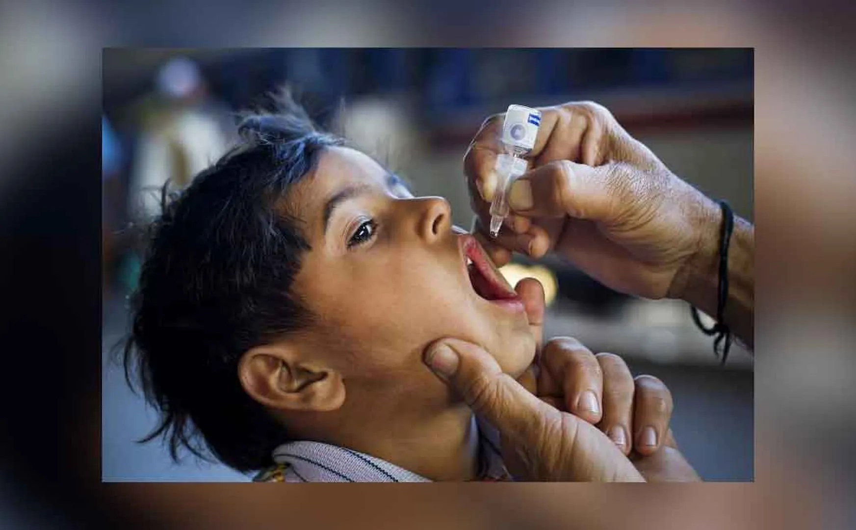polio
