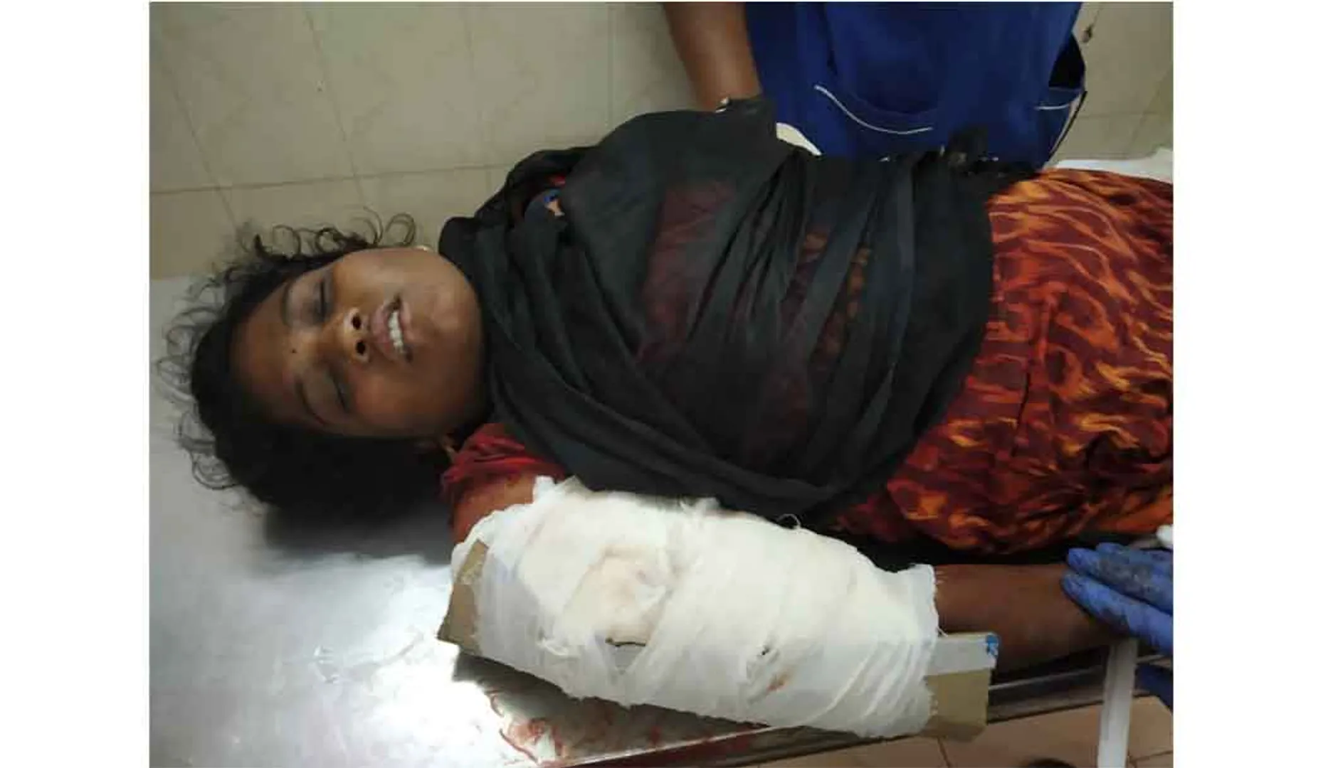 Injured