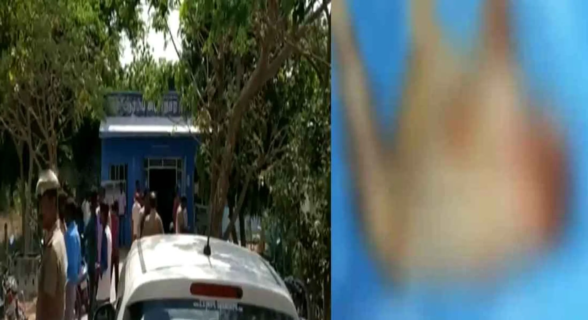  The baby born in the disconnected head in koovathur 