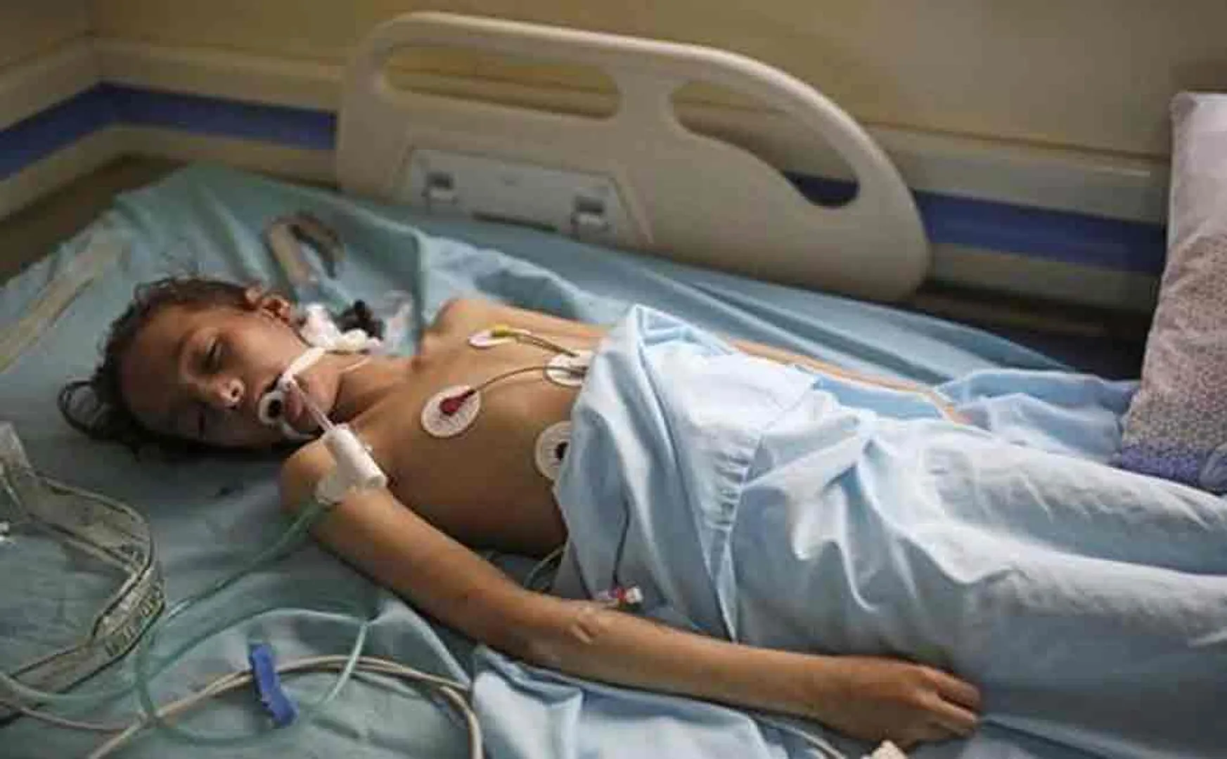 13 people including children affected in attack done by saudi and yeman 