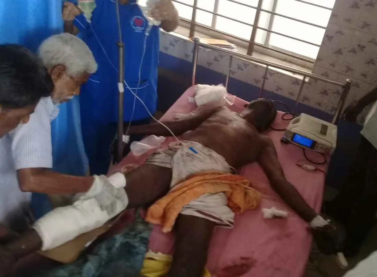 worker's foot is cut