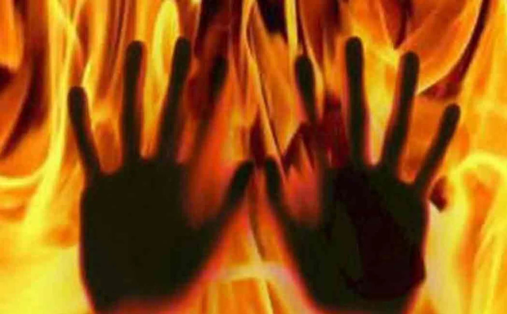 couple set on fire for doing intercaste marriage 