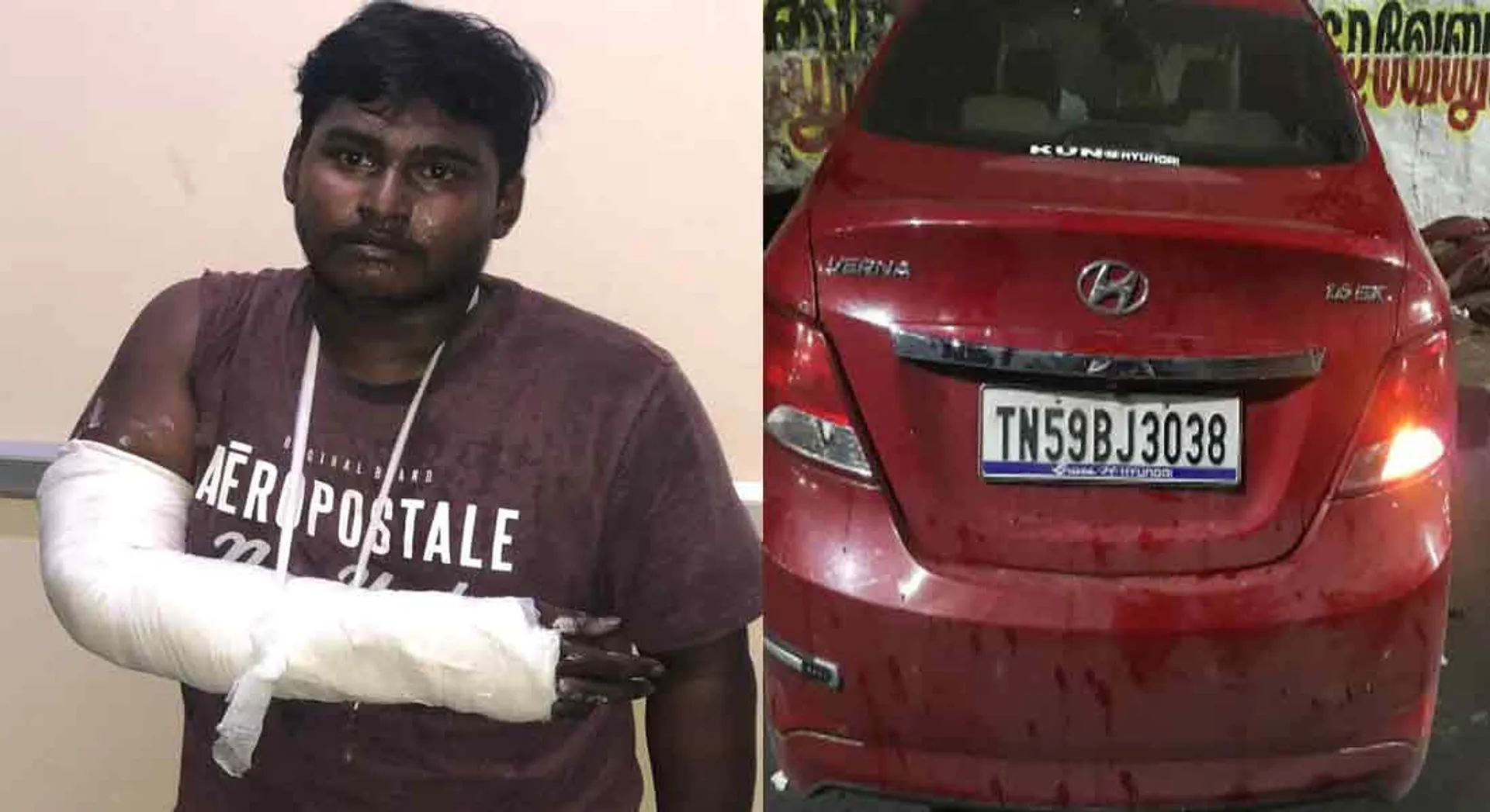  Minister's son is the attacker of the police?