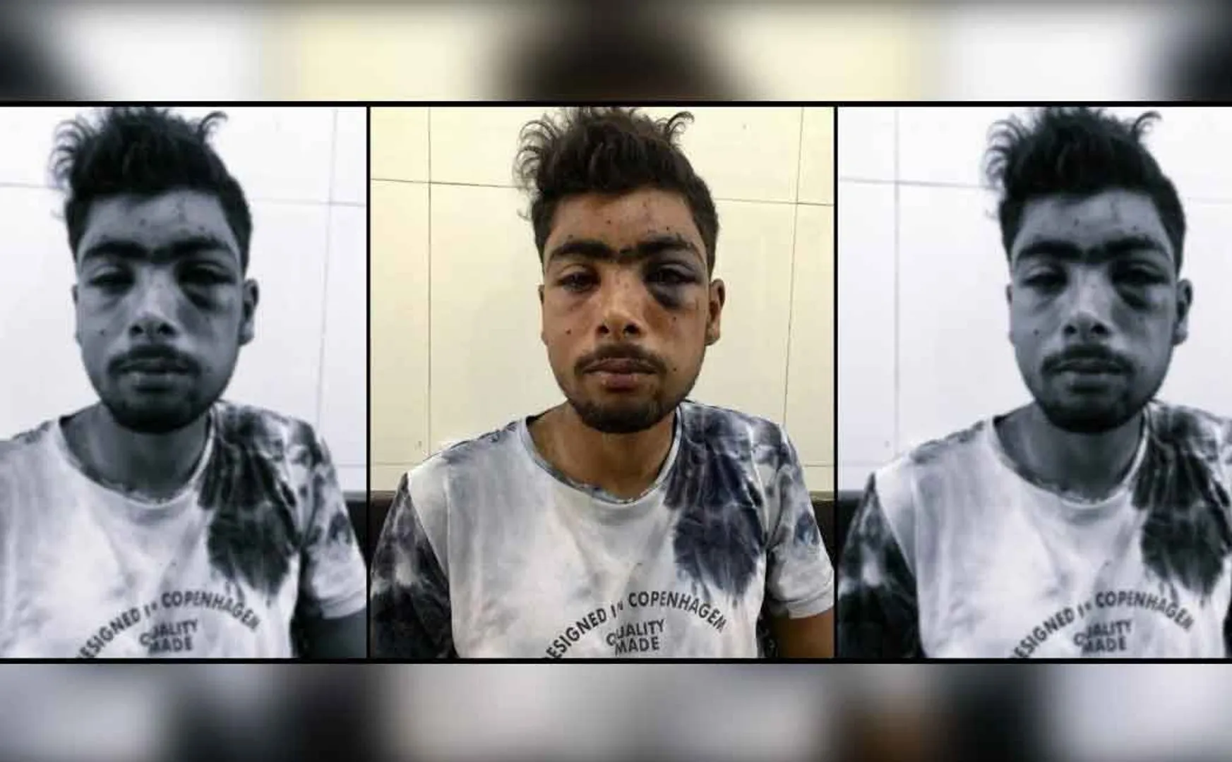 pellet victim