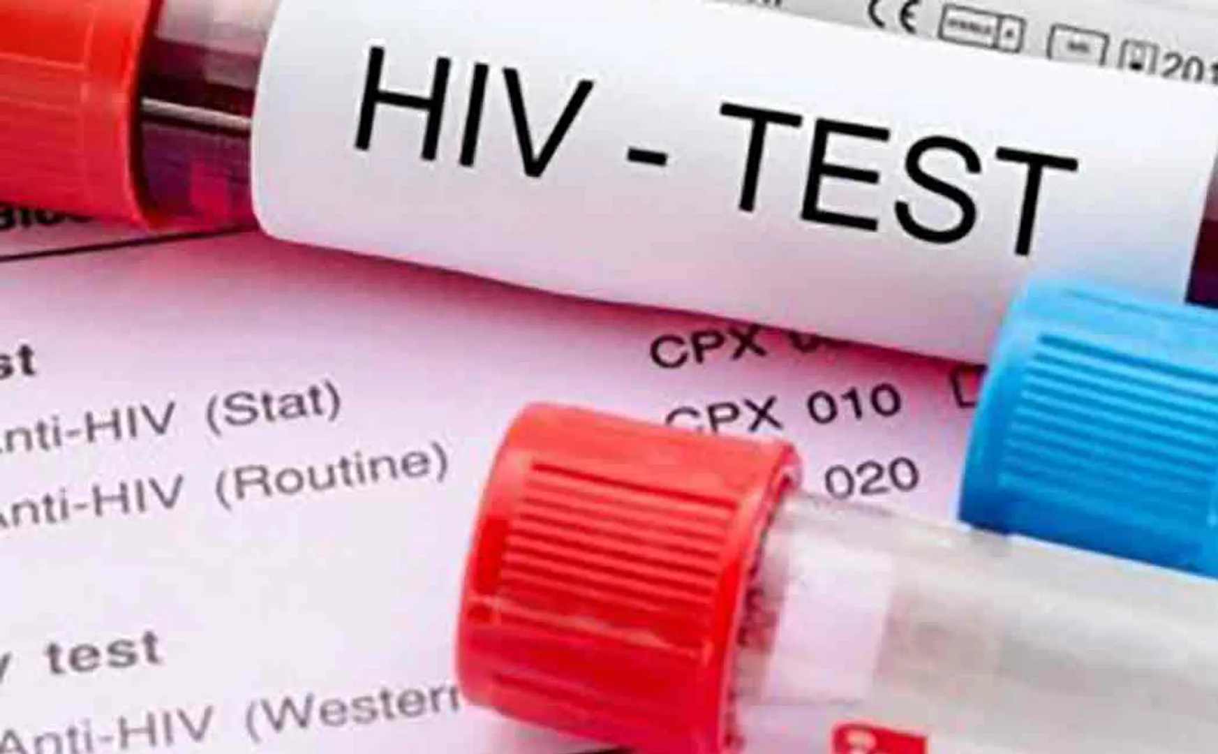 doctor misdiagnoses aids test in simla