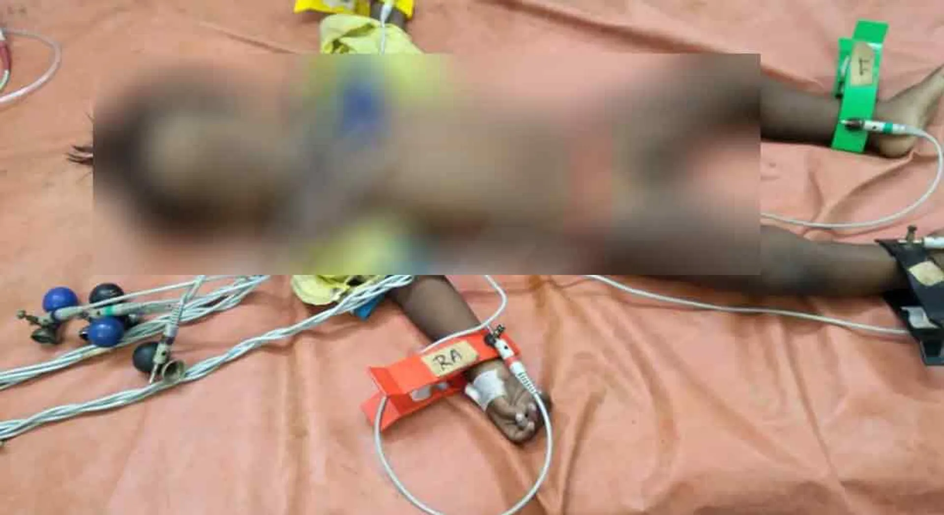  2 year old baby dies after eating rat killing biscut of as biscuits